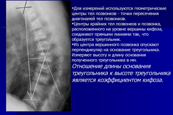 Впн для кракена